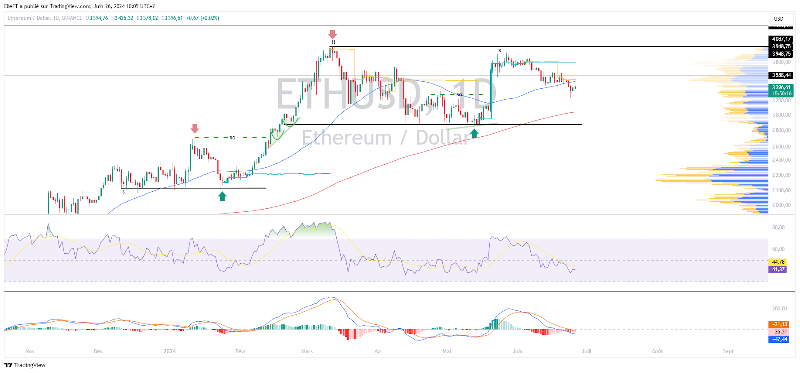 ETH/USD Chart (1D)